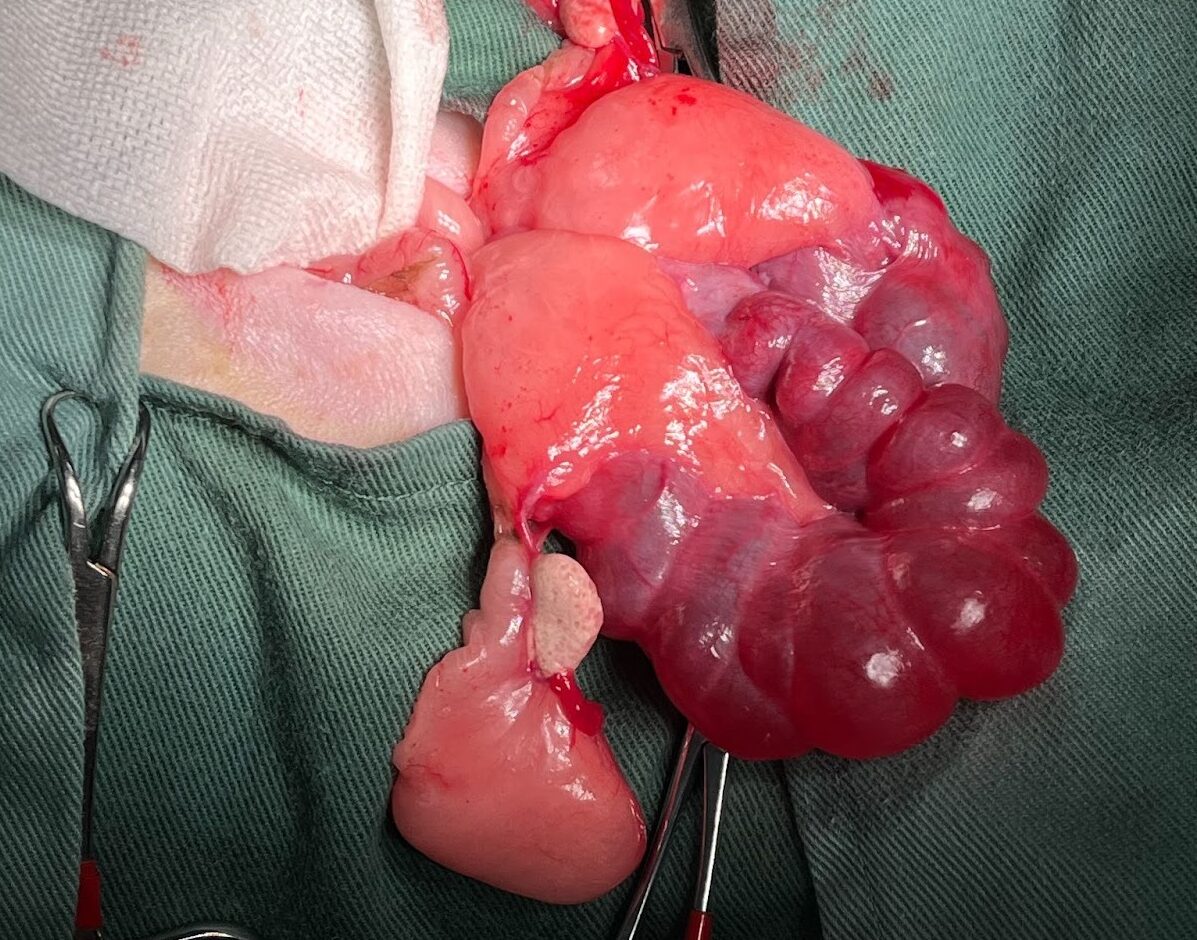 写真：子宮腫瘍の手術中の様子